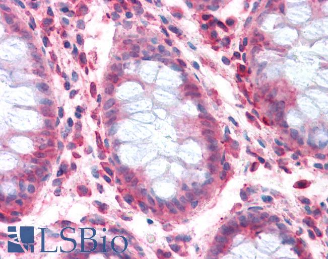 Anti-SLC1A4 antibody LS-A8978 IHC of human colon. Immunohistochemistry of formalin-fixed, paraffin-embedded tissue after heat-induced antigen retrieval.