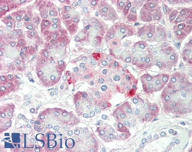 Human, Pancreas: Formalin-Fixed Paraffin-Embedded (FFPE)