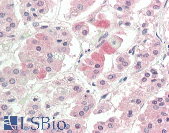 Human, Adrenal: Formalin-Fixed Paraffin-Embedded (FFPE)