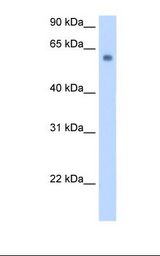Transfected 293T cell lysate. Antibody concentration: 0.25 ug/ml. Gel concentration: 12%.