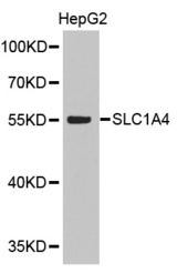 Western blot analysis of extracts of HepG2 cell lines, using SLC1A4 antibody.