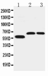 WB of SLC1A4 / ASCT1 antibody. Lane 1: U87 Cell Lysate. Lane 2: Rat Brain Tissue Lysate. Lane 3: Mouse Brain Tissue Lysate.