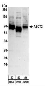 Detection of Human ASCT2 by Western Blot. Samples: Whole cell lysate (50 ug) from HeLa, 293T, and Jurkat cells. Antibodies: Affinity purified rabbit anti-ASCT2 antibody used for WB at 0.1 ug/ml. Detection: Chemiluminescence with an exposure time of 3 minutes.