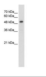 Jurkat Cell Lysate