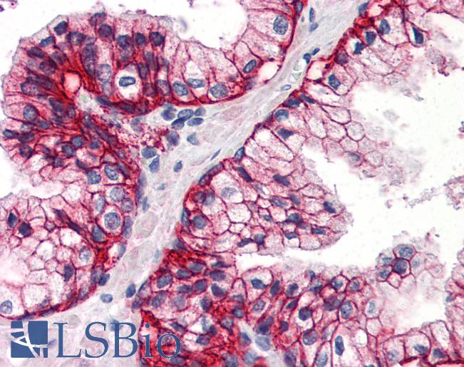 Anti-SLC1A5 antibody LS-A9774 IHC of human prostate. Immunohistochemistry of formalin-fixed, paraffin-embedded tissue after heat-induced antigen retrieval.