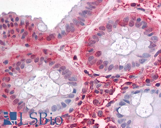 Anti-SLC1A5 antibody LS-A9044 IHC of human colon. Immunohistochemistry of formalin-fixed, paraffin-embedded tissue after heat-induced antigen retrieval.