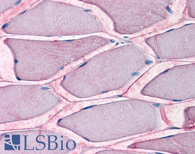Anti-SLC1A5 antibody LS-A9043 IHC of human skeletal muscle. Immunohistochemistry of formalin-fixed, paraffin-embedded tissue after heat-induced antigen retrieval.