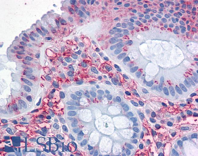 Anti-SLC1A5 antibody LS-A9043 IHC of human colon. Immunohistochemistry of formalin-fixed, paraffin-embedded tissue after heat-induced antigen retrieval.