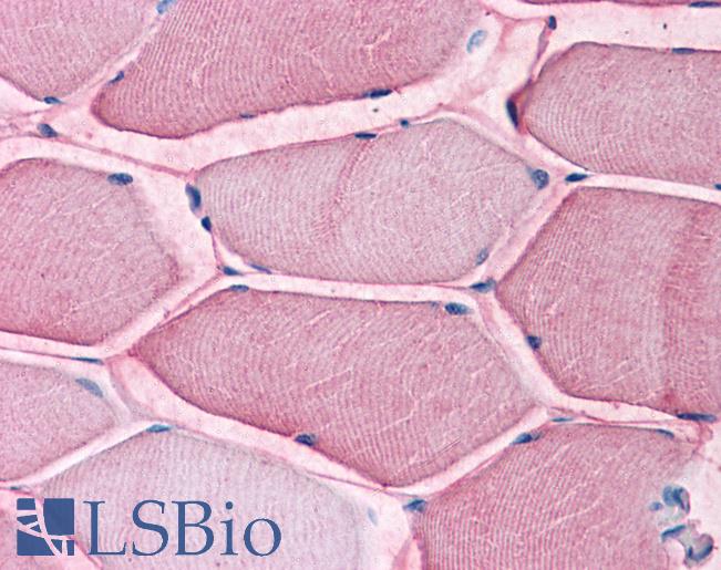 Anti-SLC1A5 antibody LS-A9042 IHC of human skeletal muscle. Immunohistochemistry of formalin-fixed, paraffin-embedded tissue after heat-induced antigen retrieval.