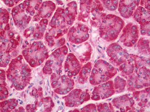 Human Pancreas: Formalin-Fixed, Paraffin-Embedded (FFPE)