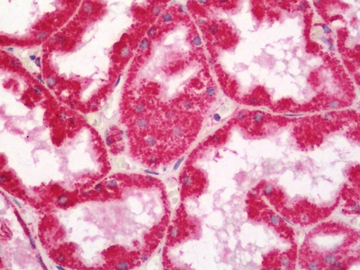 Human Kidney: Formalin-Fixed, Paraffin-Embedded (FFPE)