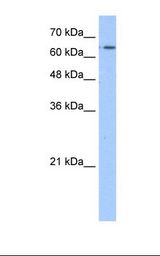 Transfected 293T cell lysate. Antibody concentration: 1.25 ug/ml. Gel concentration: 12%.