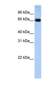 SLC22A13 antibody LS-C102058 Western blot of Placenta lysate.