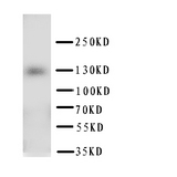 WB of ptch2 antibody. WB: HELA Cell Lysate.