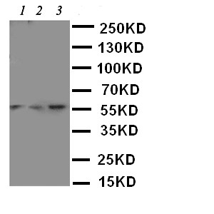 WB of SLC22A3 / OCT3 antibody. Lane 1: Rat Liver Tissue Lysate. Lane 2: 293T Cell Lysate. Lane 3: A549 Cell Lysate.