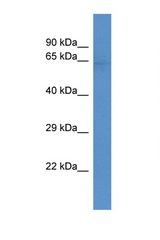 SLC22A3 antibody LS-C135152 Western blot of Mouse Heart lysate. Antibody concentration 1 ug/ml.