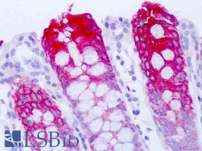 Anti-OCT3 / SLC22A3 antibody IHC of human colon epithelium. Immunohistochemistry of formalin-fixed, paraffin-embedded tissue after heat-induced antigen retrieval. Antibody LS-B8485 dilution 1:50-1:100.