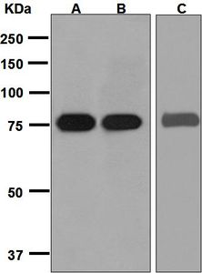 Western blot analysis on (A) fetal kidney, (B) human muscle, and (C) human placenta lysates using anti-SLC22A3 antibody.