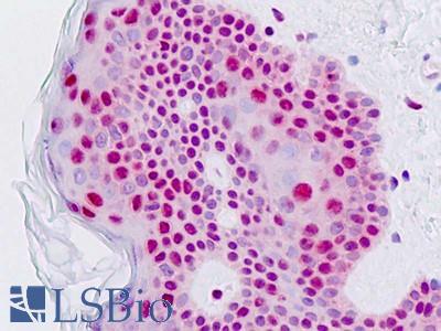 Anti-SLC22A3 / OCT3 antibody IHC staining of human skin. Immunohistochemistry of formalin-fixed, paraffin-embedded tissue after heat-induced antigen retrieval.