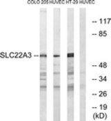 Western blot of extracts from HUVEC/COLO/HT-29 cells, using SLC22A3 Antibody. The lane on the right is treated with the synthesized peptide.