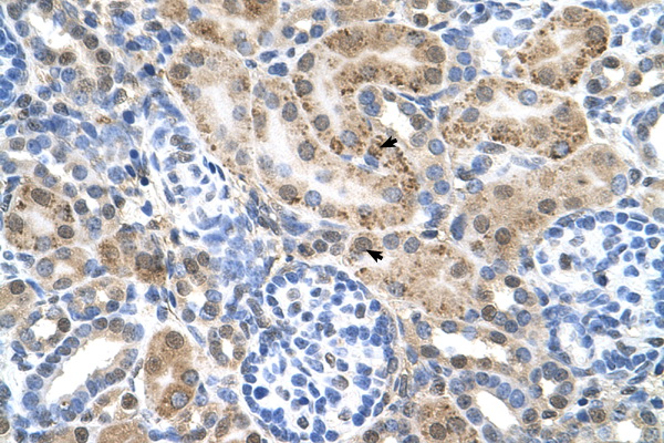 SLC22A3 antibody LS-C40440 IHC of formalin-fixed, paraffin-embedded human Kidney. Positive label: Epithelial cells of renal tubule indicated with arrows. Antibody concentration 4-8 ug/ml. Magnification 400X.