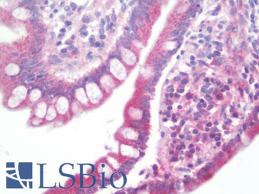 Anti-SLC22A4 / OCTN1 antibody IHC staining of human small intestine. Immunohistochemistry of formalin-fixed, paraffin-embedded tissue after heat-induced antigen retrieval.