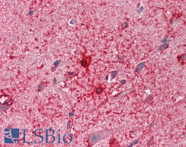 Anti-PTCH2 antibody IHC staining of human brain, cortex. Immunohistochemistry of formalin-fixed, paraffin-embedded tissue after heat-induced antigen retrieval. Antibody LS-B11475 concentration 10 ug/ml.