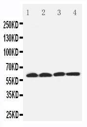 WB of SLC22A7 / OAT2 antibody. Lane 1: Rat Liver Tissue Lysate. Lane 2: Human Placenta Tissue Lysate. Lane 3: 293T Cell Lysate. Lane 4: SMMC Cell Lysate.