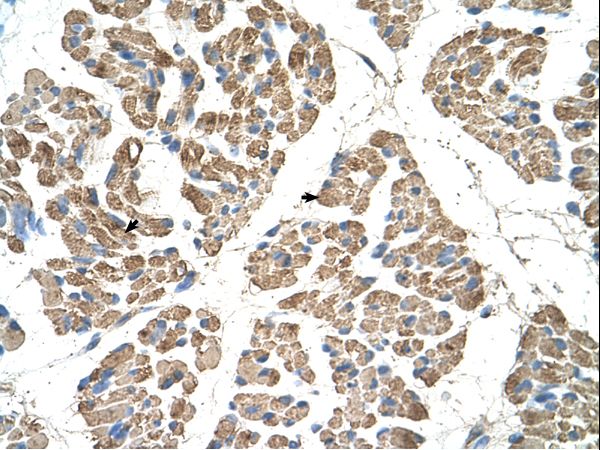 SLC22A7 antibody LS-C31903 was used in IHC to stain formalin-fixed, paraffin-embedded human muscle.