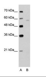 A: Marker, B: Jurkat Cell Lysate