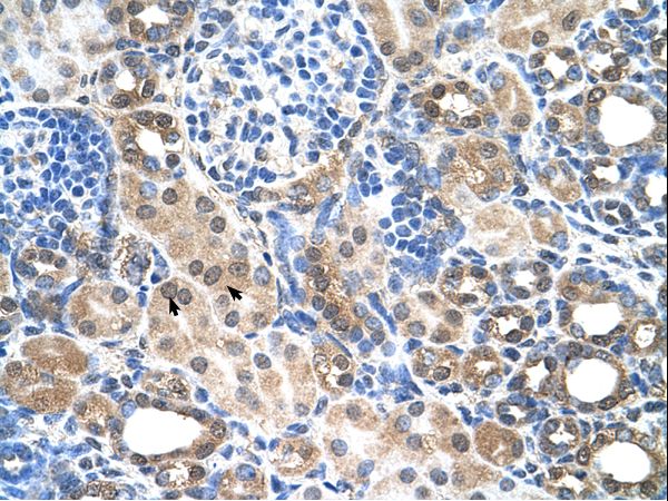 SLC22A7 antibody LS-C40397 was used in IHC to stain formalin-fixed, paraffin-embedded human kidney.