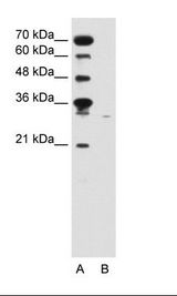 A: Marker, B: Jurkat Cell Lysate
