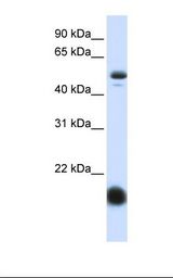 Fetal liver lysate. Antibody concentration: 1.0 ug/ml. Gel concentration: 12%.