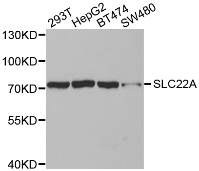 Western blot analysis of extracts of various cell lines, using SLC22A8antibody.