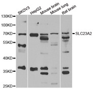 Western blot analysis of extracts of various cell lines, using SLC23A2 antibody.