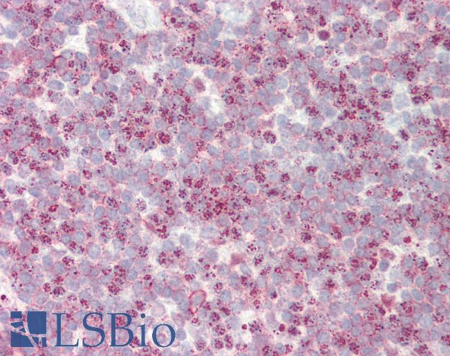 Anti-SLC24A1 / NCKX antibody IHC staining of human tonsil. Immunohistochemistry of formalin-fixed, paraffin-embedded tissue after heat-induced antigen retrieval. Antibody LS-B9700 concentration 10 ug/ml.