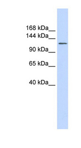 SLC24A1 antibody Western blot of Fetal Brain lysate.