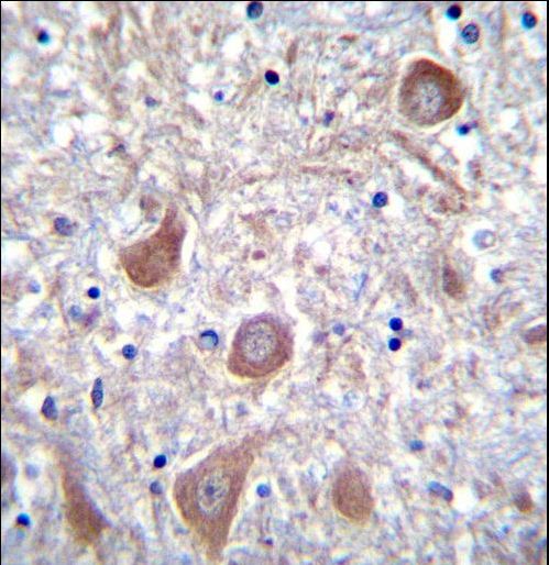 PTCHD1 Antibody immunohistochemistry of formalin-fixed and paraffin-embedded human brain tissue followed by peroxidase-conjugated secondary antibody and DAB staining.