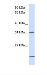 721_B cell lysate. Antibody concentration: 1.0 ug/ml. Gel concentration: 12%.
