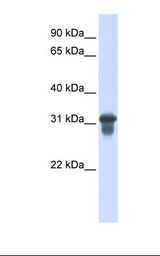Transfected 293T cell lysate. Antibody concentration: 1.0 ug/ml. Gel concentration: 12%.