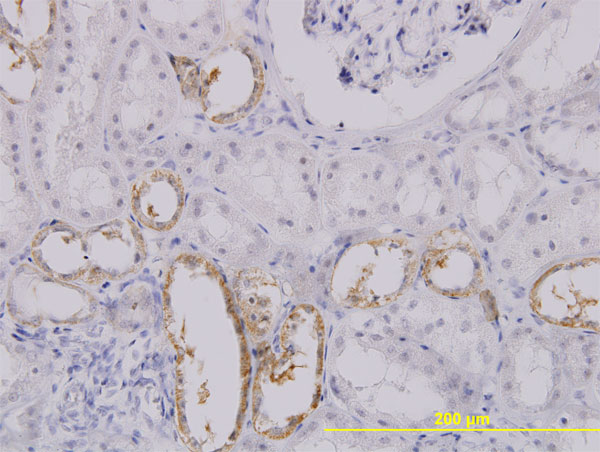 Immunoperoxidase of monoclonal antibody to SLC25A11 on formalin-fixed paraffin-embedded human kidney. [antibody concentration 3 ug/ml]