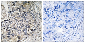 IHC of paraffin-embedded human prostate carcinoma tissue, using CMC1 Antibody. The picture on the right is treated with the synthesized peptide.