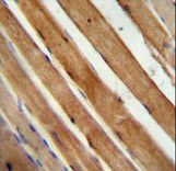 SLC25A12 antibody immunohistochemistry of formalin-fixed and paraffin-embedded human skeletal muscle followed by peroxidase-conjugated secondary antibody and DAB staining.
