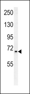 SLC25A12 Antibody western blot of mouse bladder tissue lysates (15 ug/lane). The SLC25A12 antibody detected SLC25A12 protein (arrow).