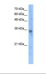 Transfected 293T cell lysate. Antibody concentration: 5.0 ug/ml. Gel concentration: 12%.
