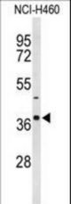Western blot of SLC25A17 Antibody in NCI-H460 cell line lysates (35 ug/lane). SLC25A17 (arrow) was detected using the purified antibody.