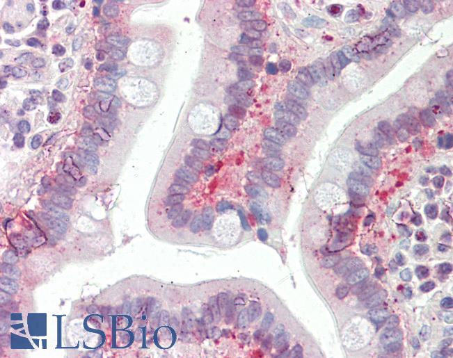Anti-SLC25A19 antibody IHC staining of human small intestine. Immunohistochemistry of formalin-fixed, paraffin-embedded tissue after heat-induced antigen retrieval. Antibody LS-B9893 dilution 1:100.