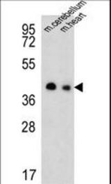 Western blot of SLC25A19 Antibody in mouse cerebellum,heart tissue lysates (35 ug/lane). SLC25A19 (arrow) was detected using the purified antibody.