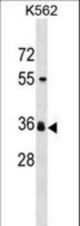 ORNT2 Antibody western blot of K562 cell line lysates (35 ug/lane). The ORNT2 antibody detected the ORNT2 protein (arrow).