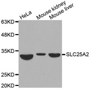 Western blot analysis of extracts of various cell lines, using SLC25A2 antibody.